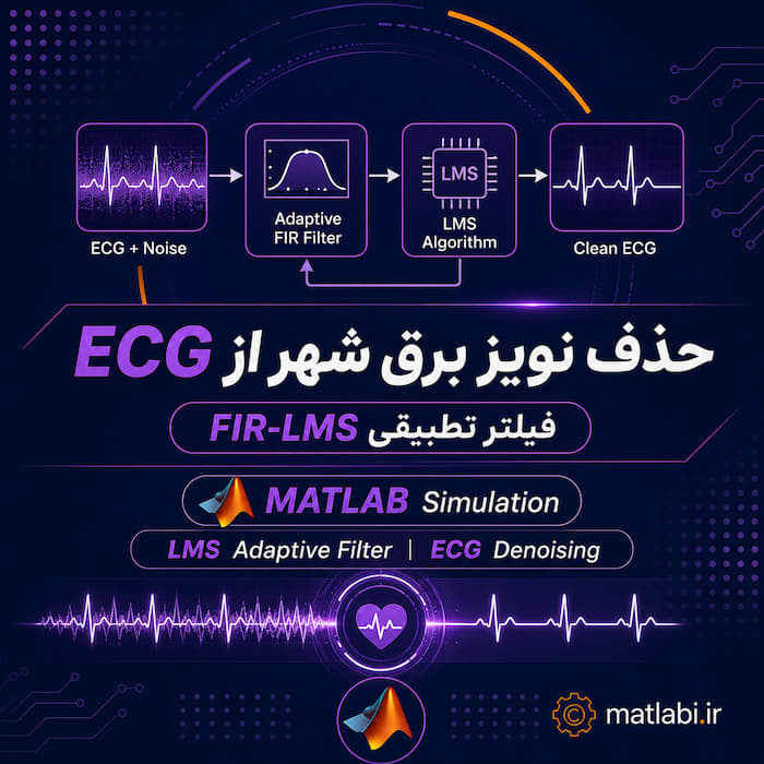 شبیهسازی حذف نویز برق شهر از سیگنال ECG با فیلتر تطبیقی FIR-LMS در متلب