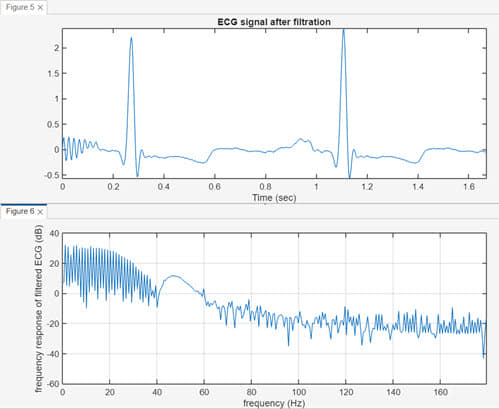 g2 سیگنال ECG تمیزشده پس از فیلتر تطبیقی LMS-FIR و طیف فرکانسی بعد از حذف نویز ۵۰ هرتز متلب