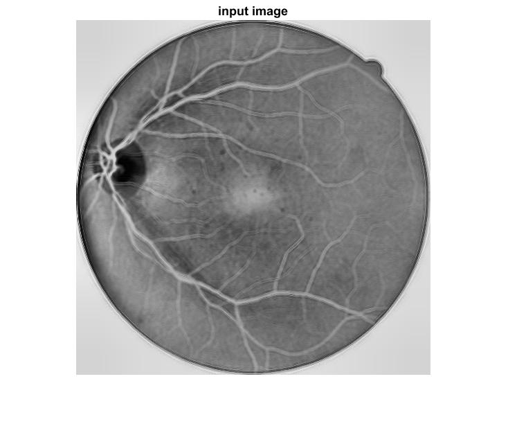 Improvement of retinal blood vessel detection using morphological component analysis