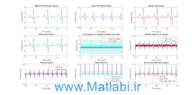 A Review of Fetal ECG Signal Processing; Issues and Promising Directions 2) Comparative analysis of fetal electrocardiogram (ECG) extraction techniques using system simulation