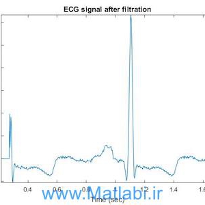 SUPPRESSION OF POWERLINE INTERFERENCE IN ECG USING ADAPTIVE DIGITAL FILTER