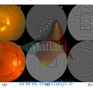 Improvement of retinal blood vessel detection using morphological component analysis