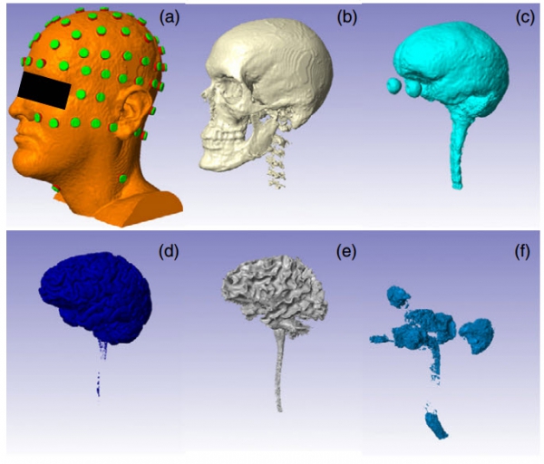 Automated MRI segmentation for individualized modeling of current flow in the human head